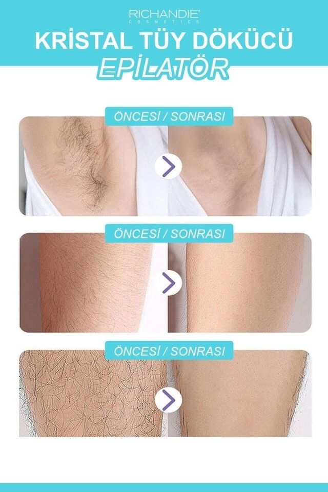 Crystal Eraser Epilasyon Aleti Tüy Silgisi Tüy Alıcı Fiziksel Kristal Tüy Dökücü Epilatör Mavi