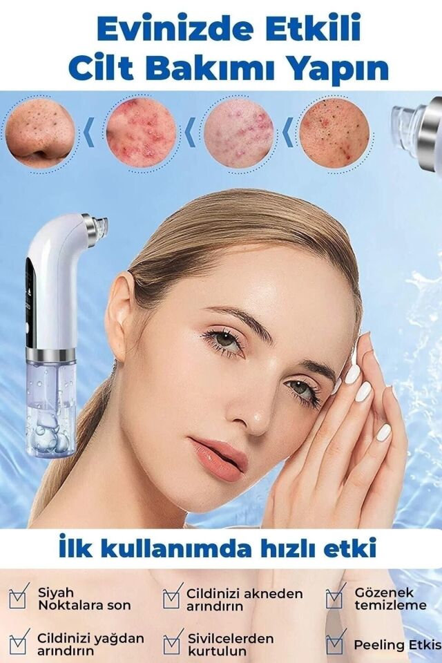 Sterilizasyonlu Vakumlu Cilt Gözenek Siyah Nokta Akne Sivilce