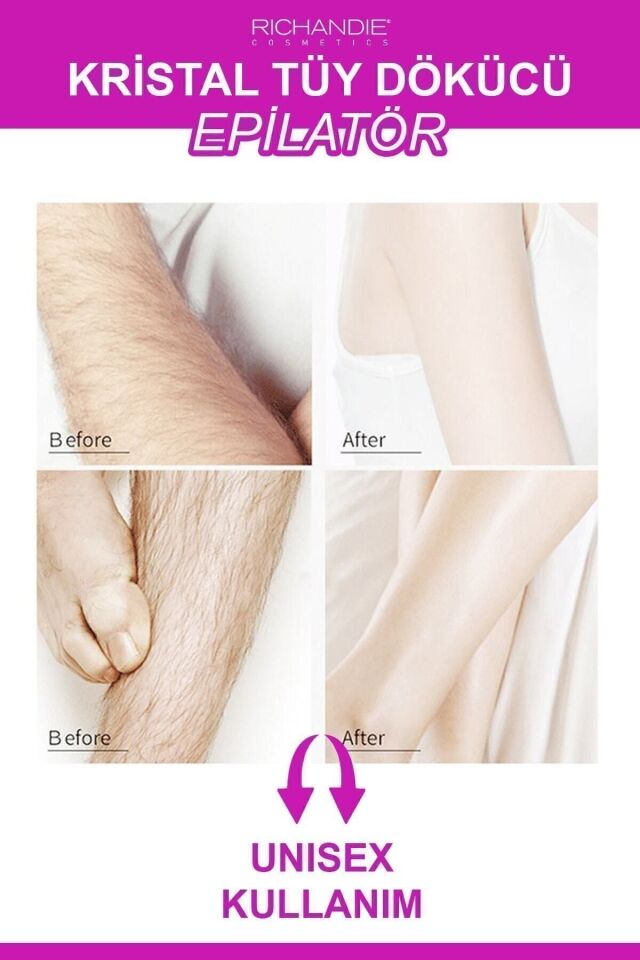 Kristal Tüy Dökücü Ağda Epilatör Crystal Eraser Epilasyon Aleti Tüy Silgisi Tüy Alıcı Fiziksel Pembe