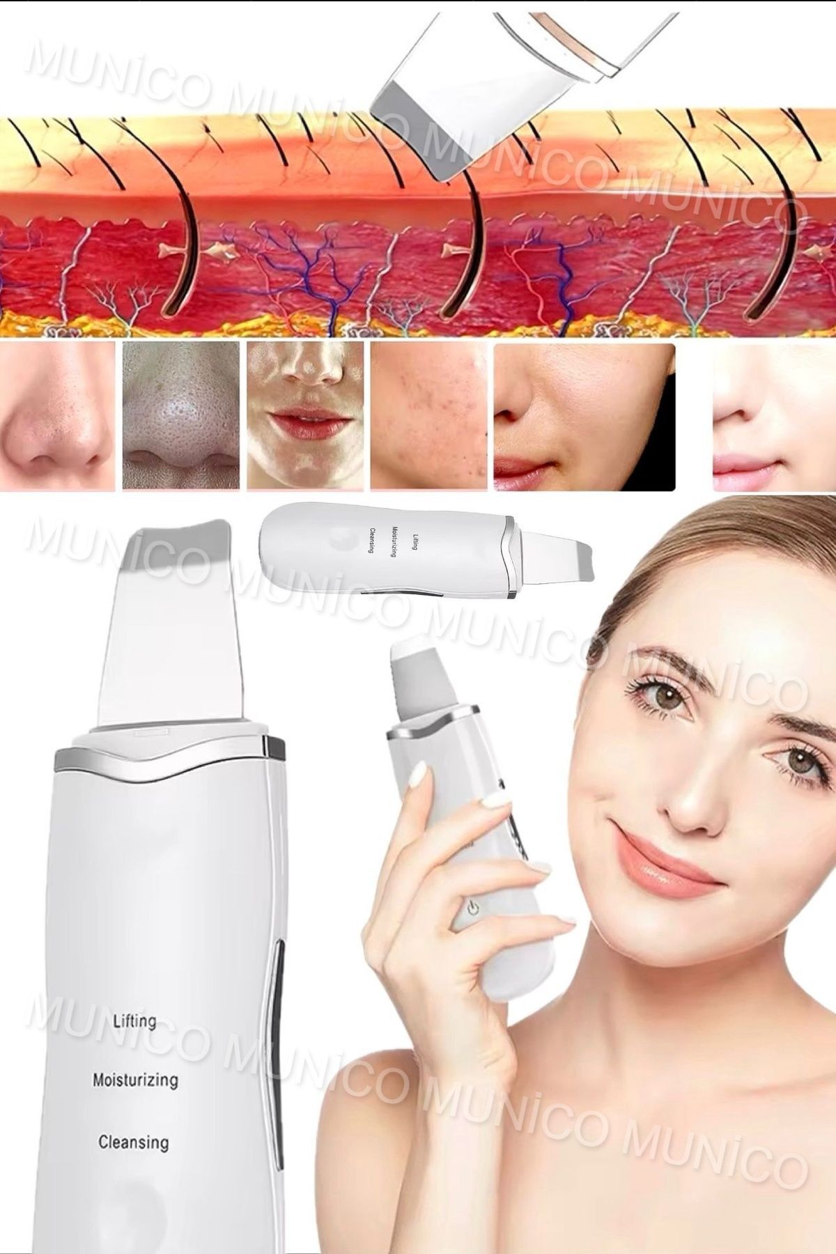 Ultrasonik Yüz Temizleyici - Akne Giderme Cihazı, Peeling Spatula Beyaz Derinlemesine Temizlik İçin