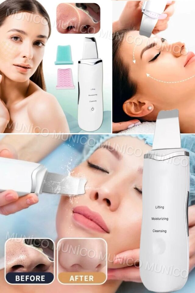 Ultrasonik Yüz Temizleyici - Akne Giderme Cihazı, Peeling Spatula Beyaz Derinlemesine Temizlik İçin